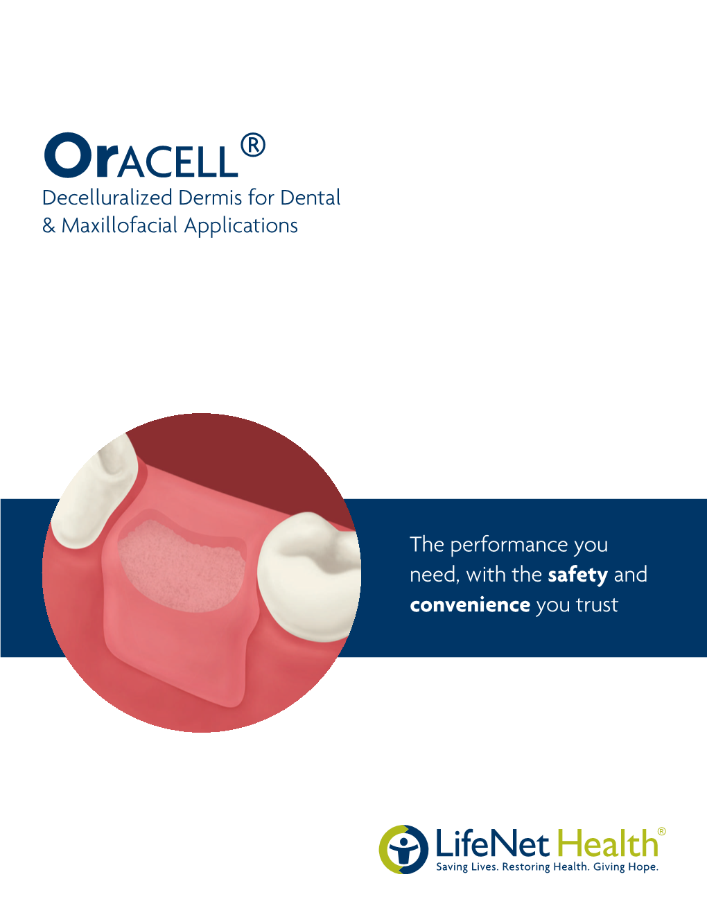 Oracell® Decelluralized Dermis for Dental & Maxillofacial Applications