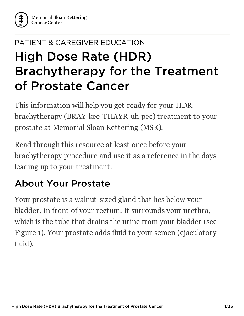 High Dose Rate (HDR) Brachytherapy for the Treatment of Prostate Cancer | Memorial Sloan Kettering Cancer Center