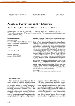 Acneiform Eruption Induced by Cetuximab