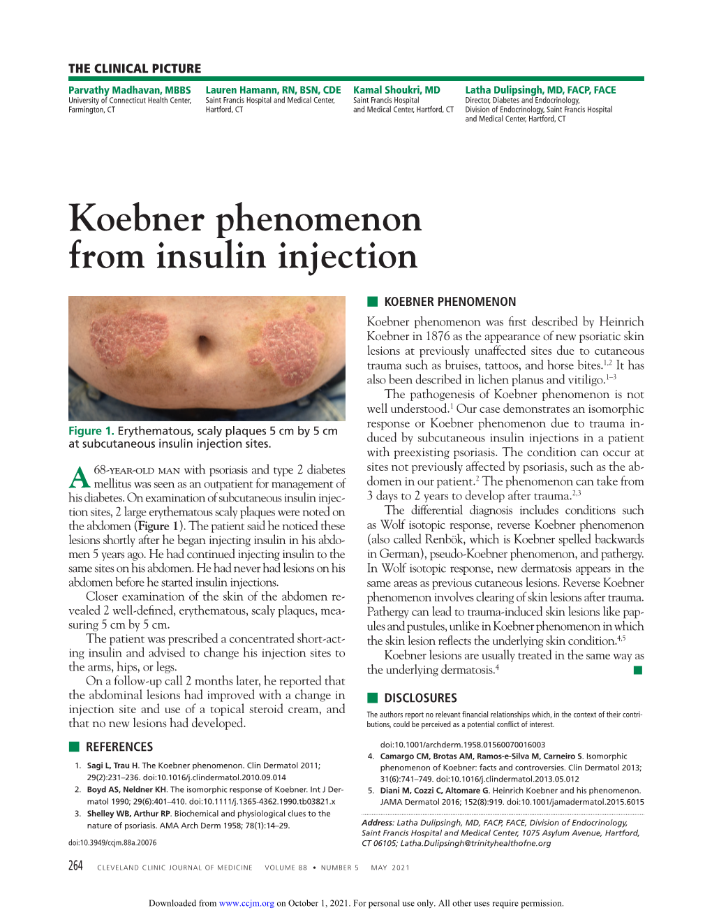 Koebner Phenomenon from Insulin Injection