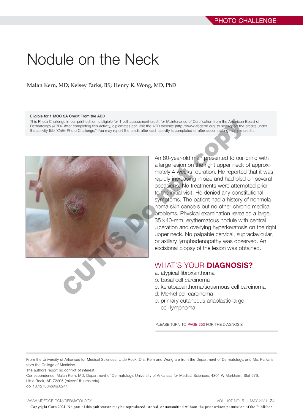 Nodule on the Neck