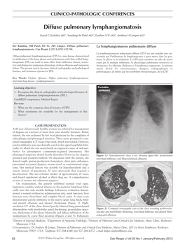 Diffuse Pulmonary Lymphangiomatosis
