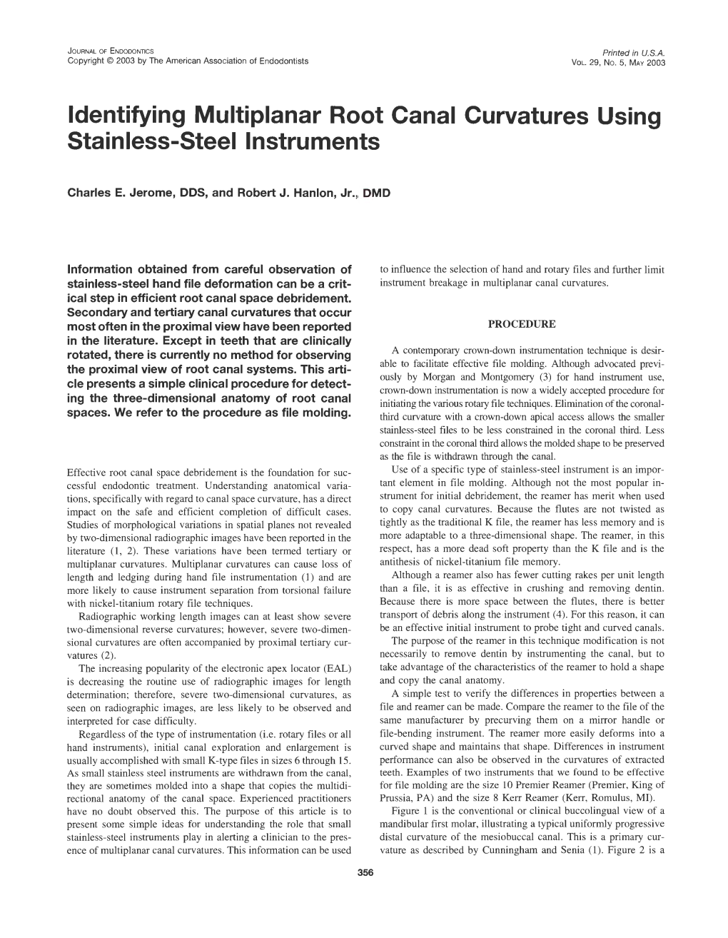 Identifying Multiplanar Root Canal Curvatures Using Stainless-Steel Instruments