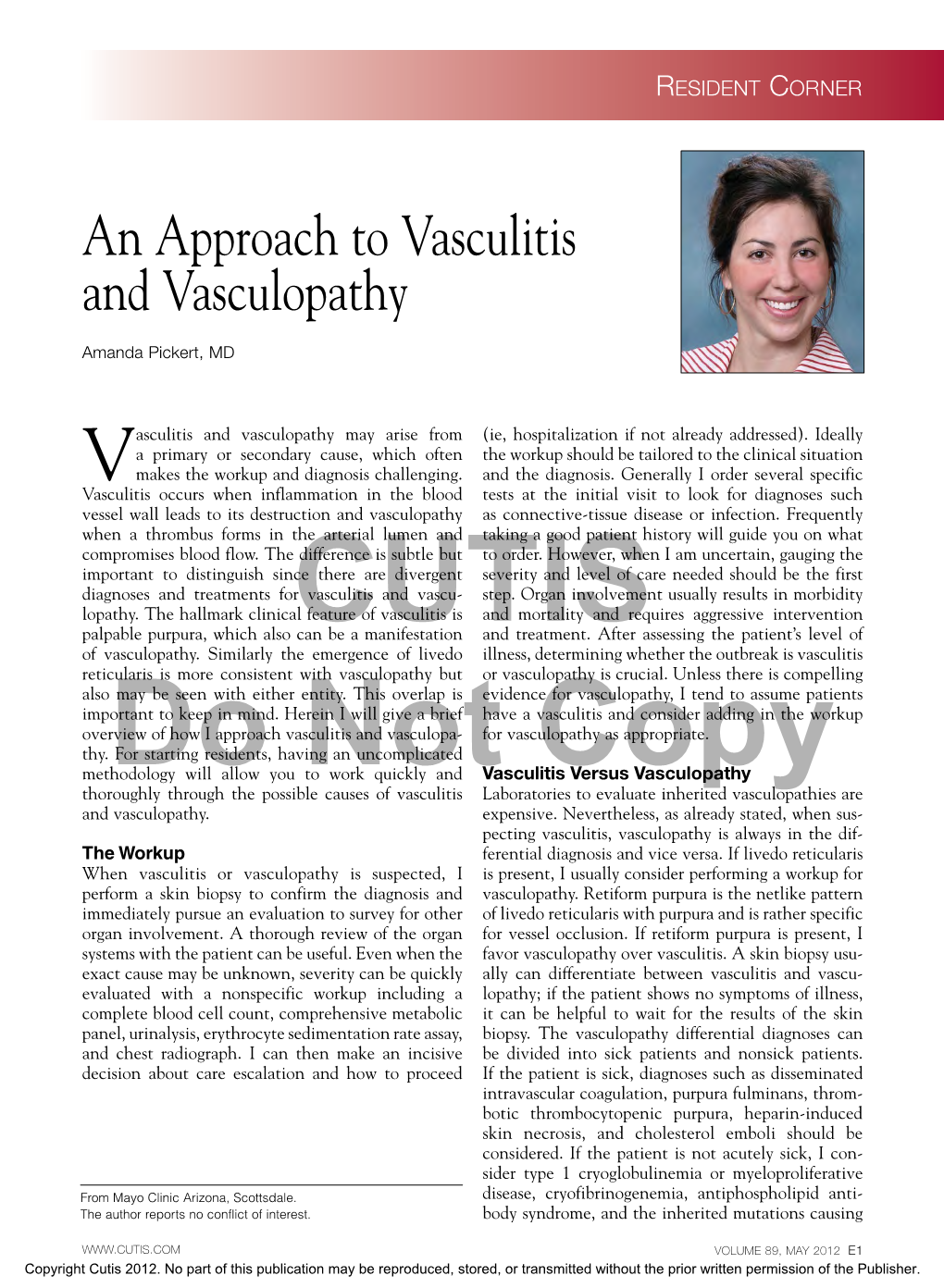 An Approach to Vasculitis and Vasculopathy