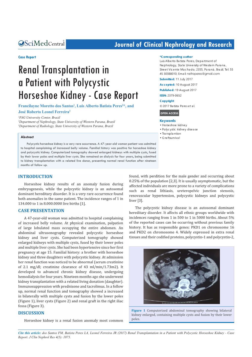 Renal Transplantation in a Patient with Polycystic Horseshoe Kidney - Case Report