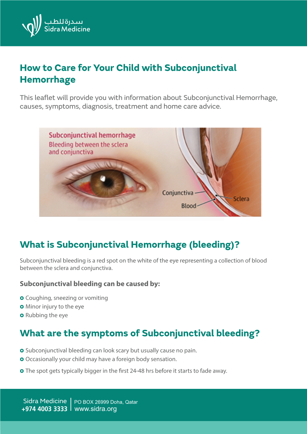Subconjunctival Haemorrhage-ENG