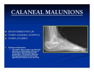 Malunited Calcaneal Fractures