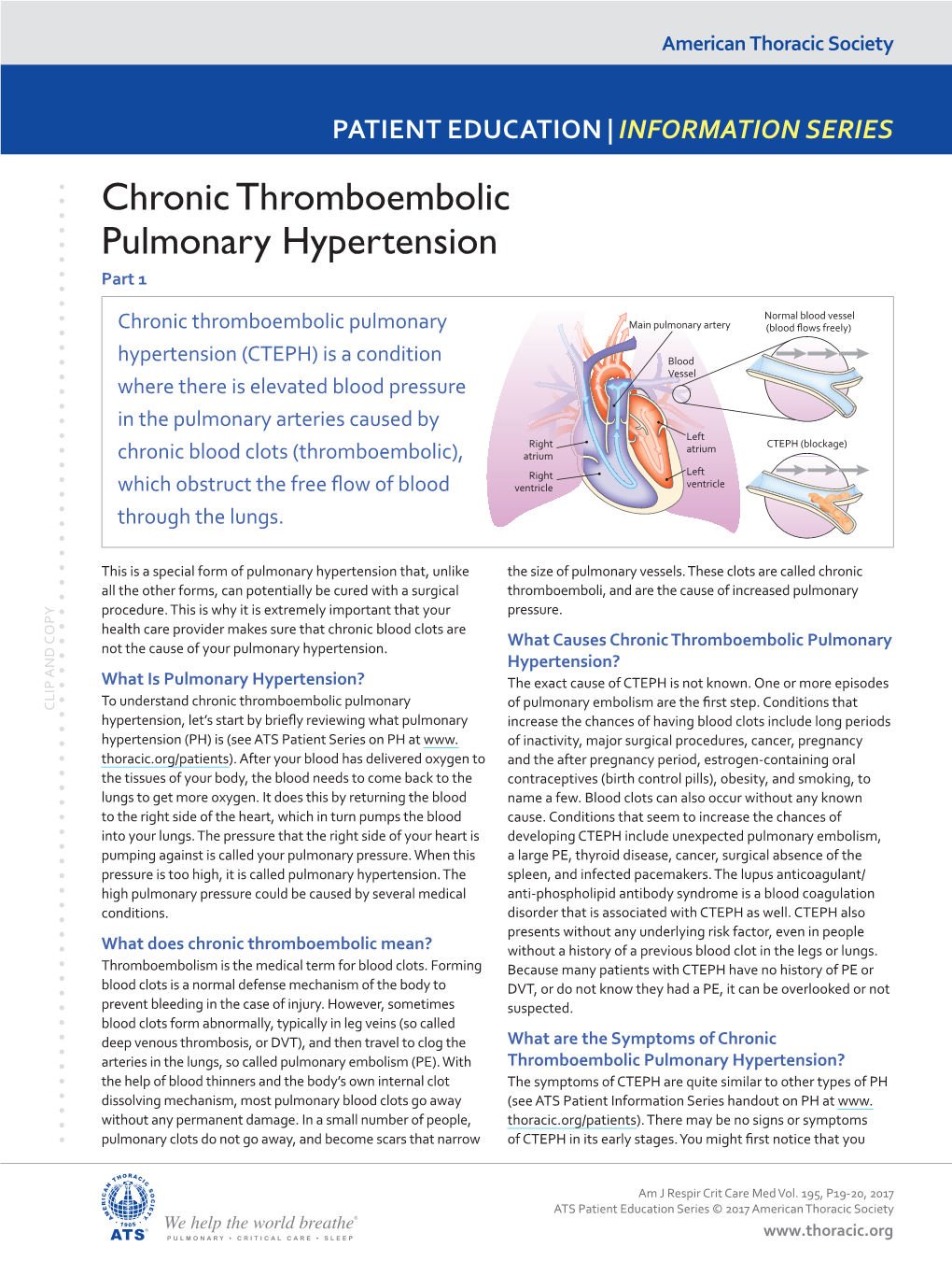 Chronic Thromboembolic Pulmonary Hypertension Part 1