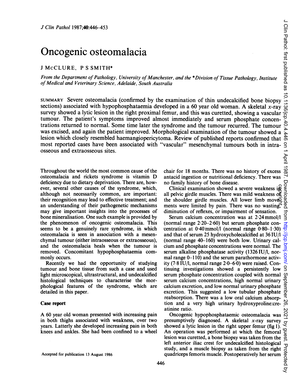 Oncogenic Osteomalacia