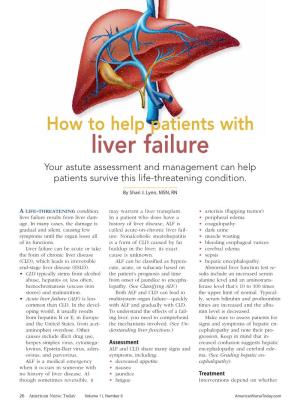 Liver Failure Your Astute Assessment and Management Can Help Patients Survive This Life-Threatening Condition