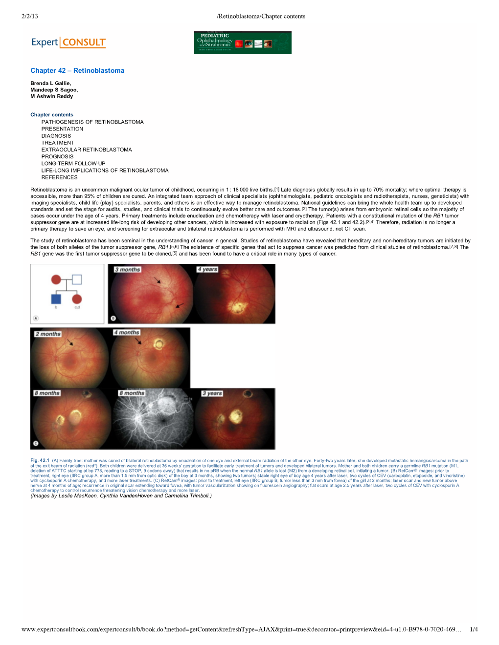 Retinoblastoma Tumor Collection