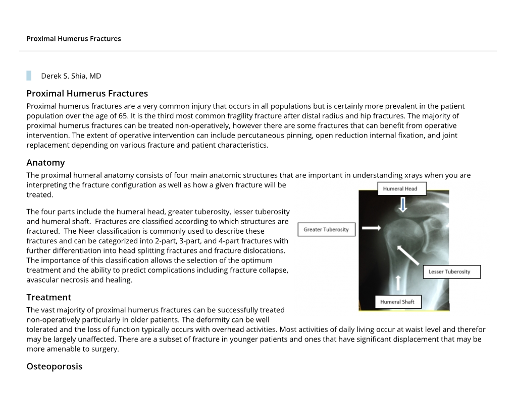 Proximal Humerus Fractures Anatomy Treatment Osteoporosis