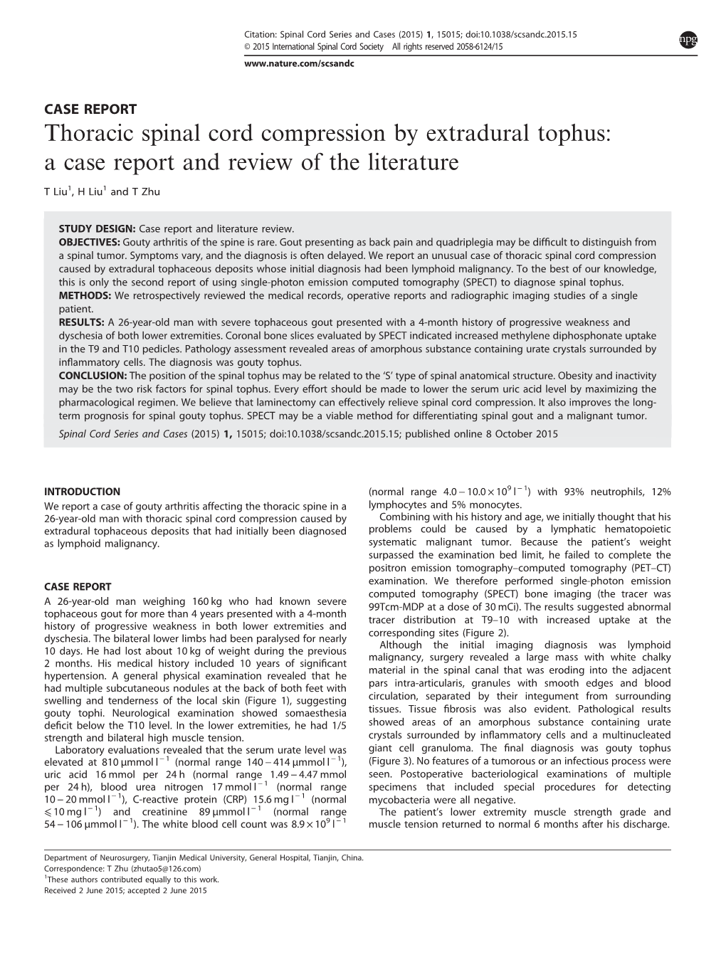 Thoracic Spinal Cord Compression by Extradural Tophus: a Case Report and Review of the Literature