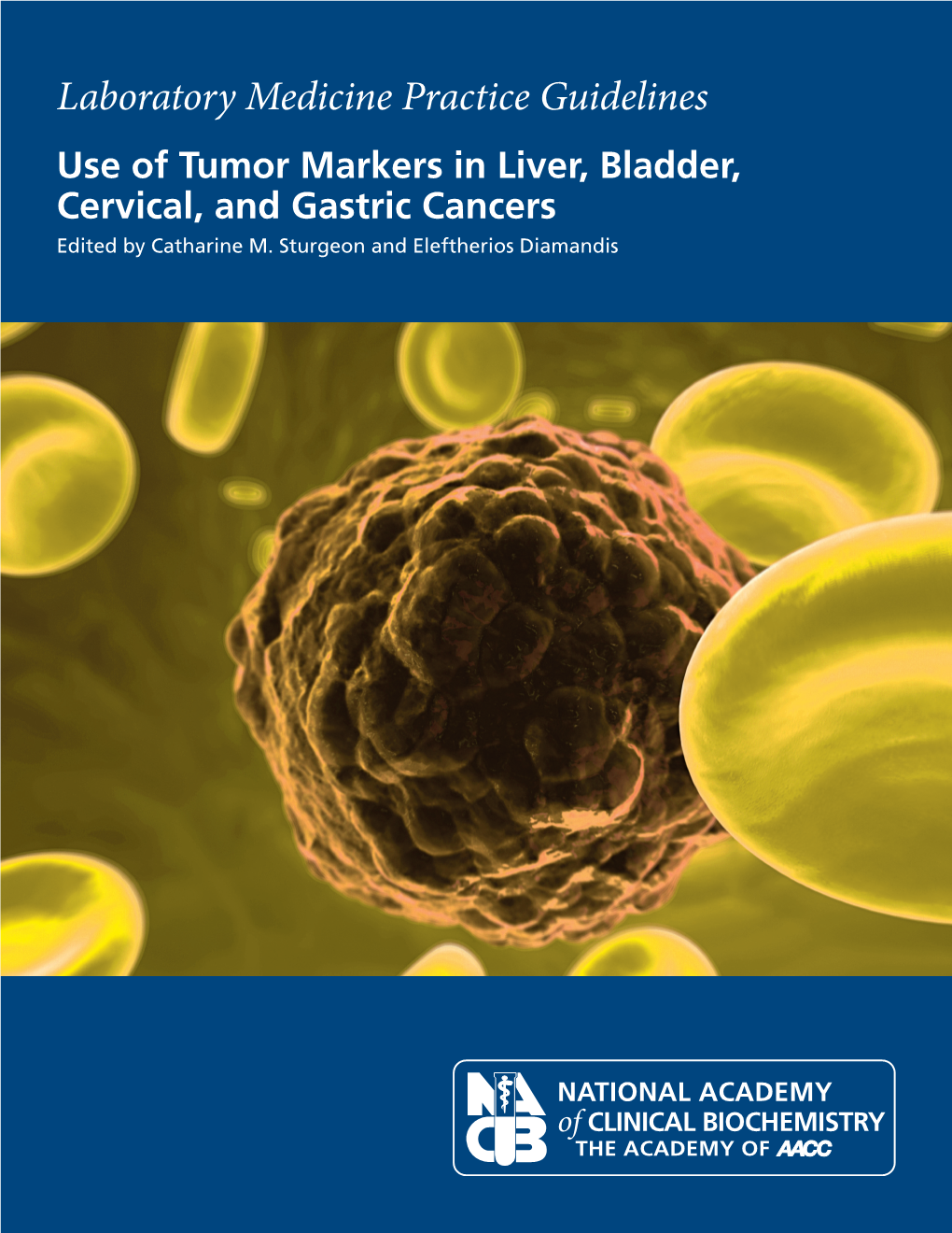 Use of Tumor Markers in Liver, Bladder, Cervical, and Gastric Cancers Edited by Catharine M