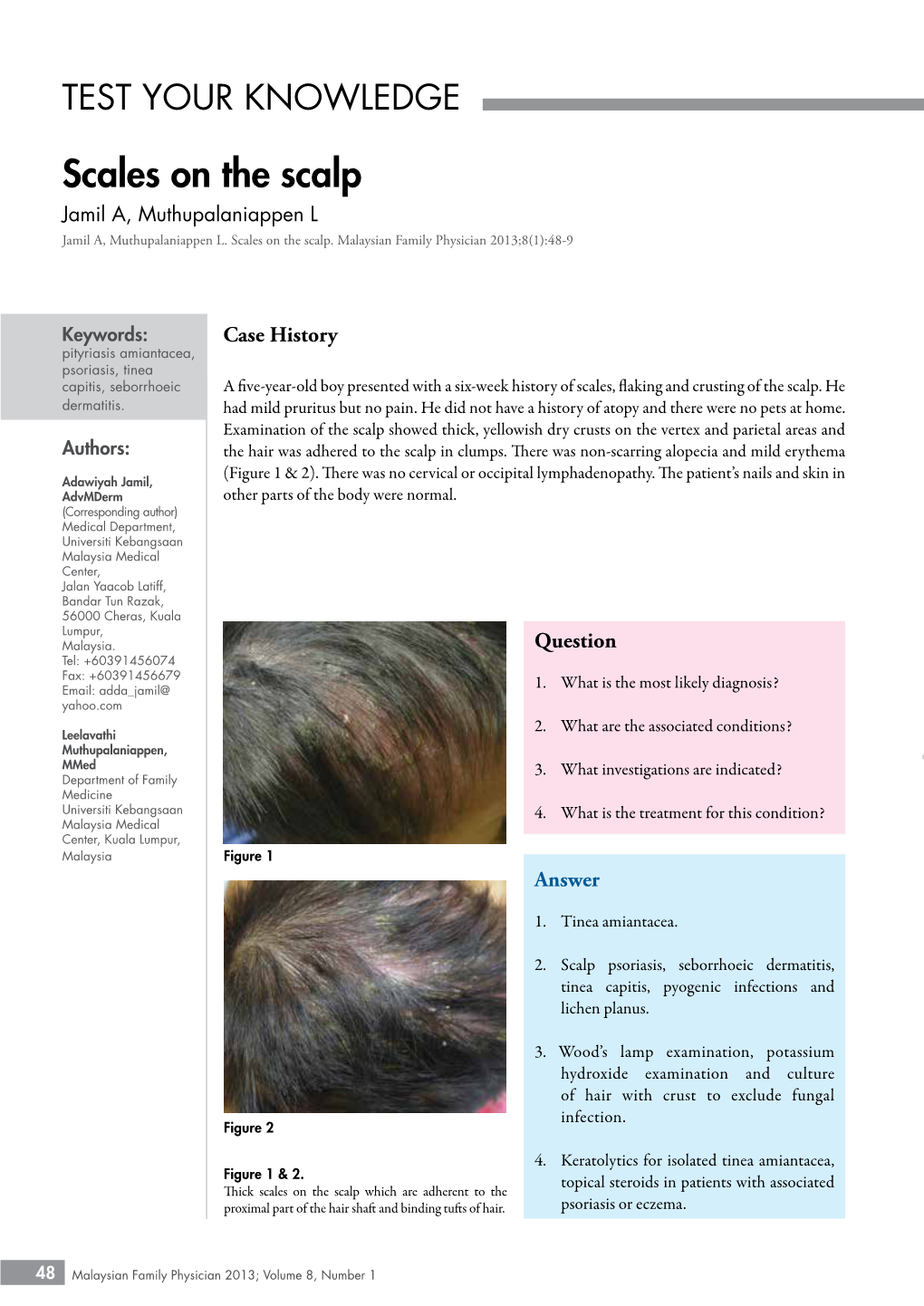 Scales on the Scalp Jamil A, Muthupalaniappen L Jamil A, Muthupalaniappen L