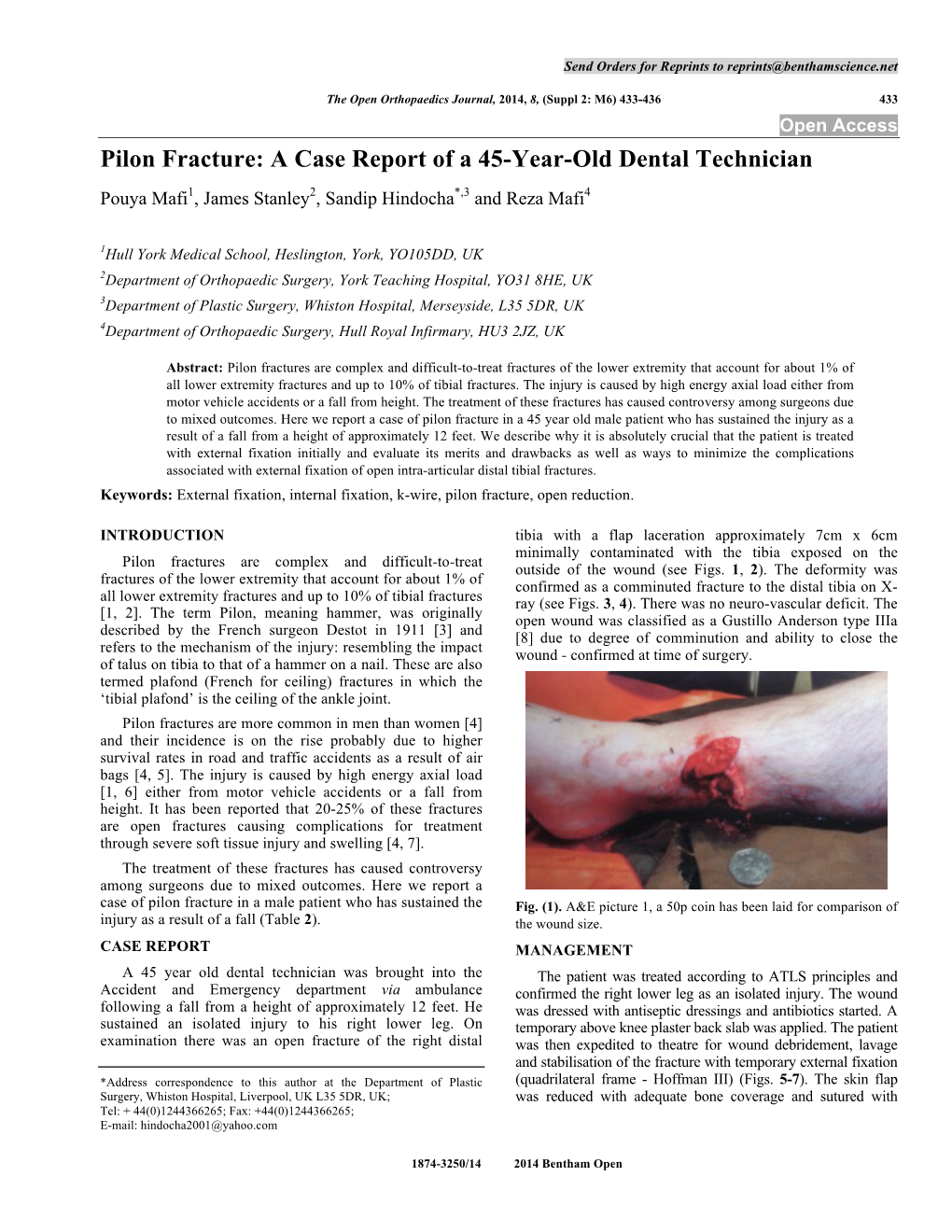 Pilon Fracture: a Case Report of a 45-Year-Old Dental Technician Pouya Mafi1, James Stanley2, Sandip Hindocha*,3 and Reza Mafi4