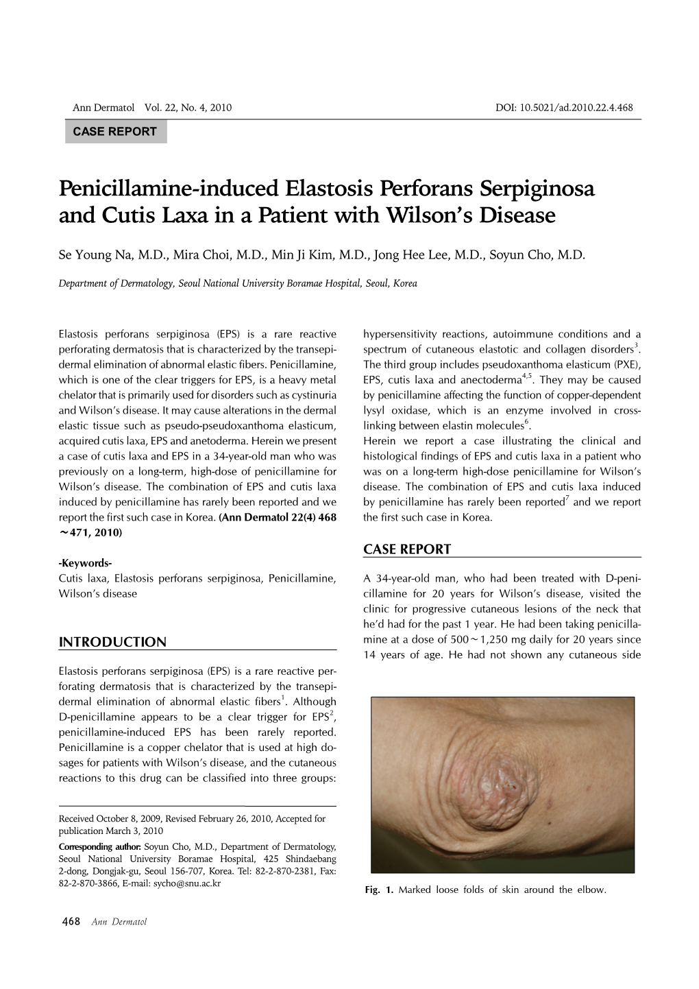 Penicillamine-Induced Elastosis Perforans Serpiginosa and Cutis Laxa in a Patient with Wilson’S Disease