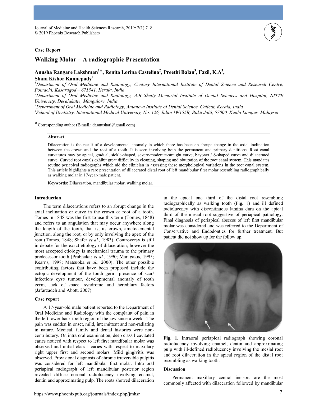 Walking Molar – a Radiographic Presentation