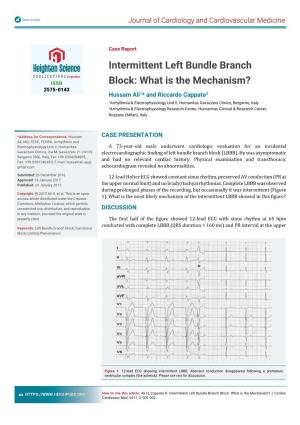 Intermittent Left Bundle Branch Block: What Is the Mechanism? J Cardiol Cardiovasc Med