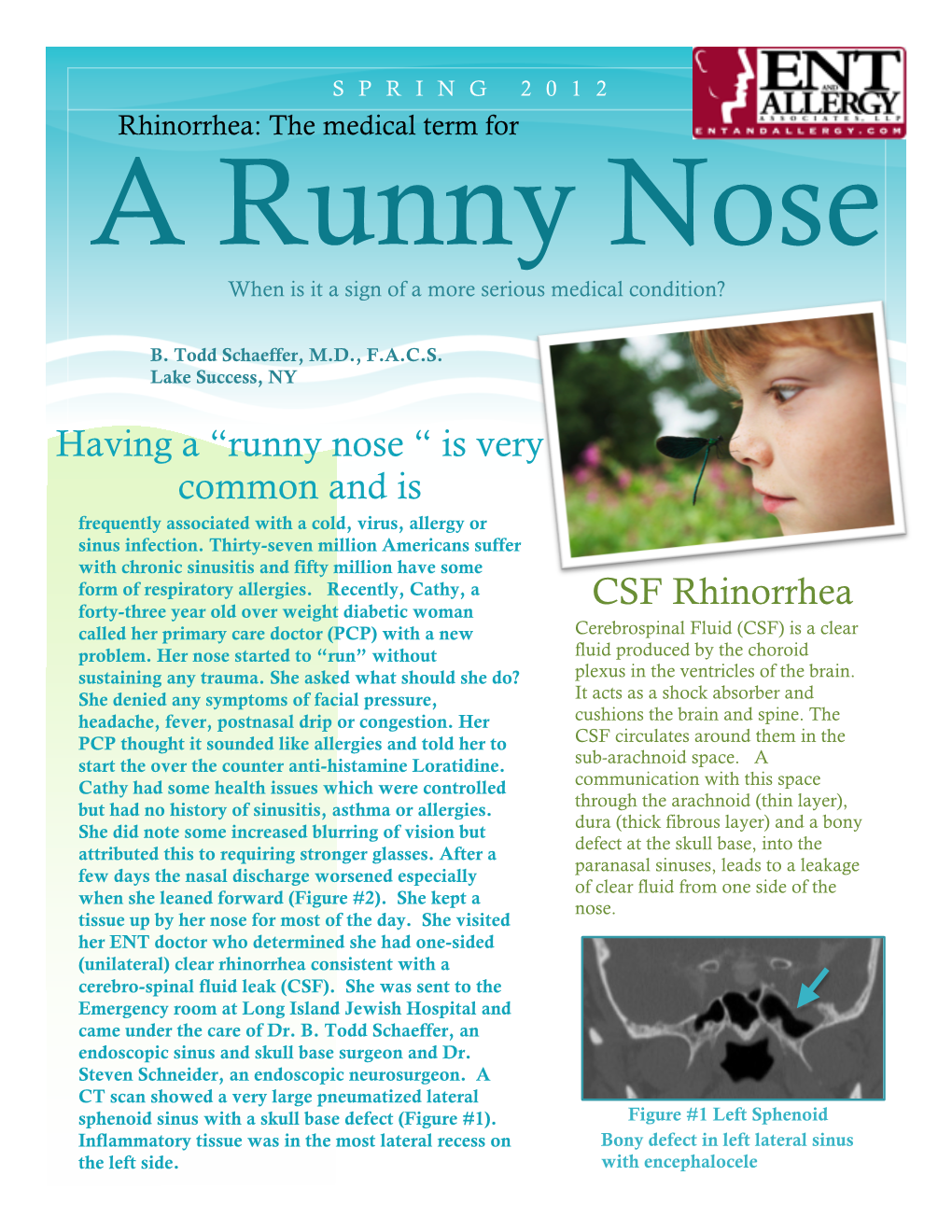 Runny Nose When Is It a Sign of a More Serious Medical Condition?