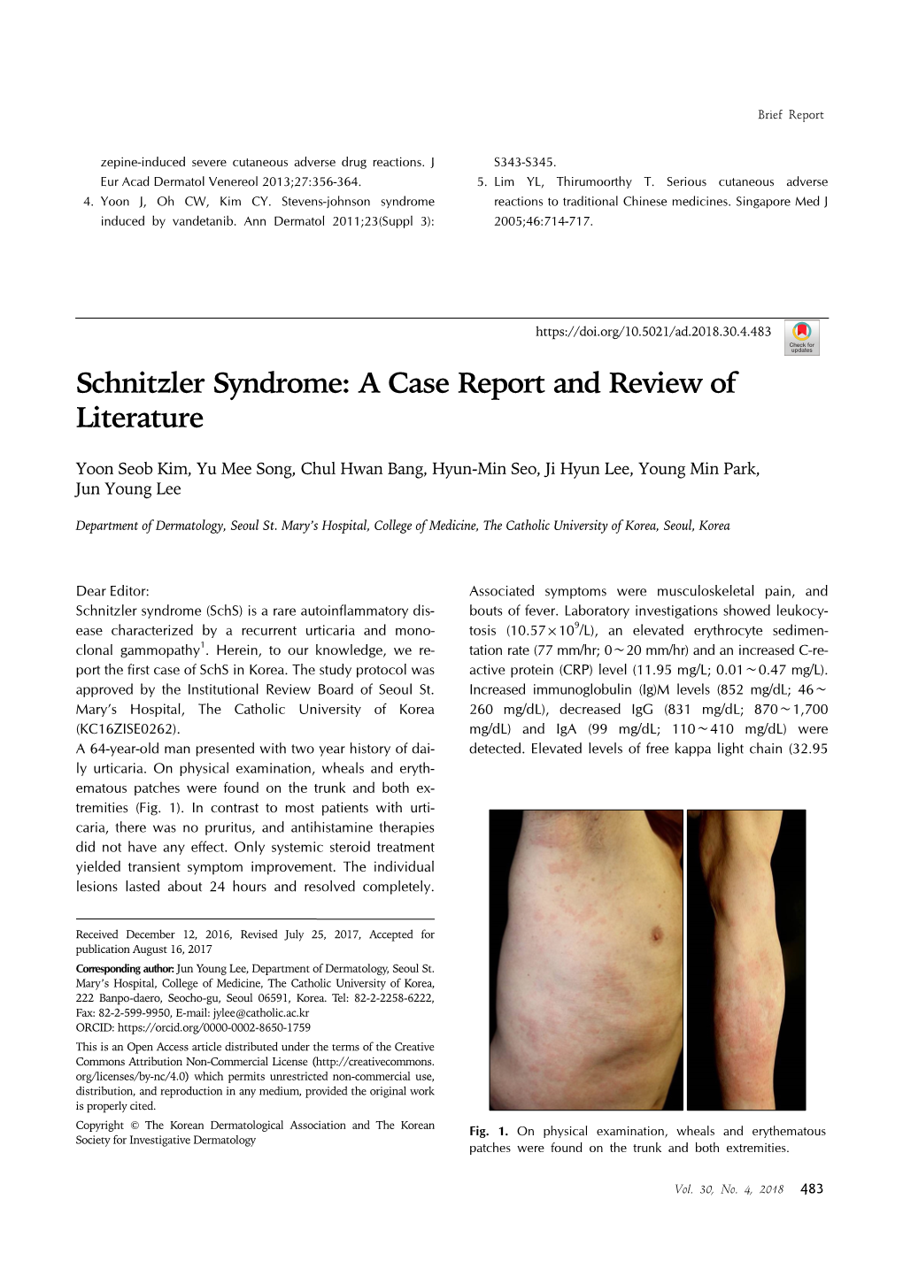 Schnitzler Syndrome: a Case Report and Review of Literature