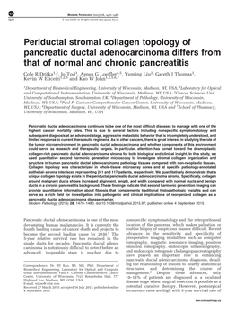 Periductal Stromal Collagen Topology of Pancreatic Ductal