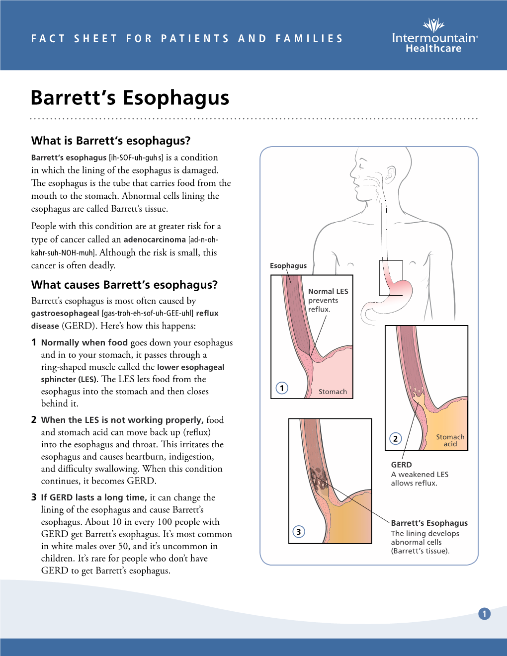 Barretts Esophagus Fact Sheet DocsLib