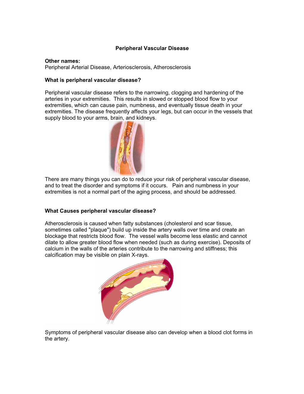 Peripheral Vascular Disease Other Names: Peripheral Arterial Disease, Arteriosclerosis, Atherosclerosis What Is Peripheral Vascu