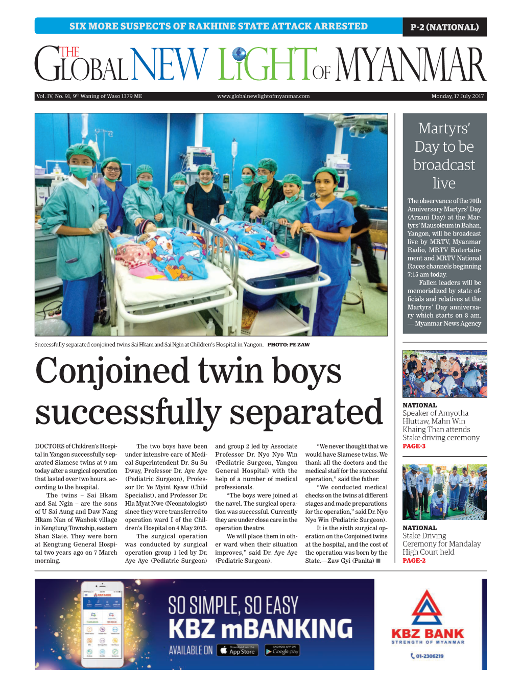 Conjoined Twin Boys Successfully Separated