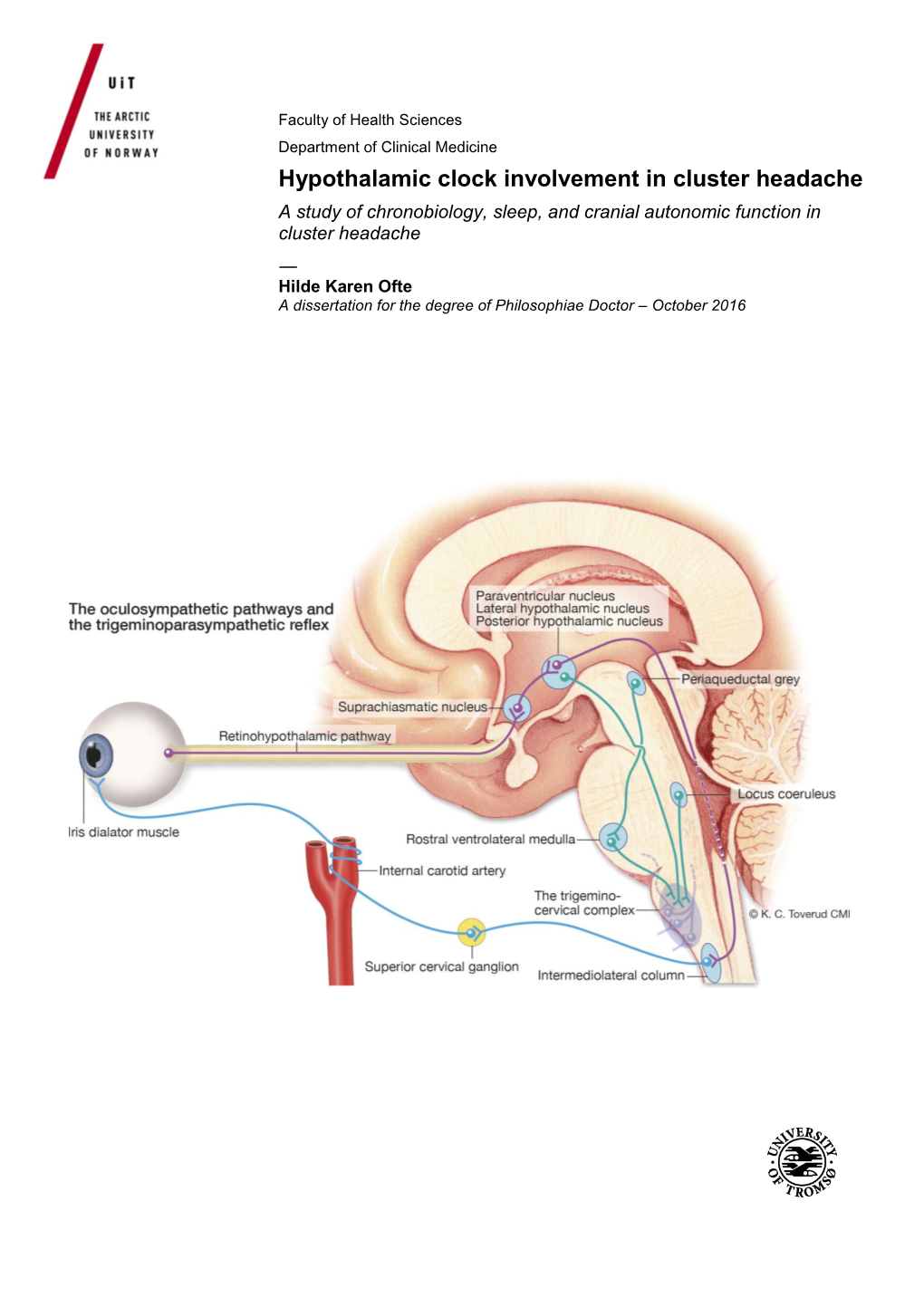 Hypothalamic Clock Involvement in Cluster Headache