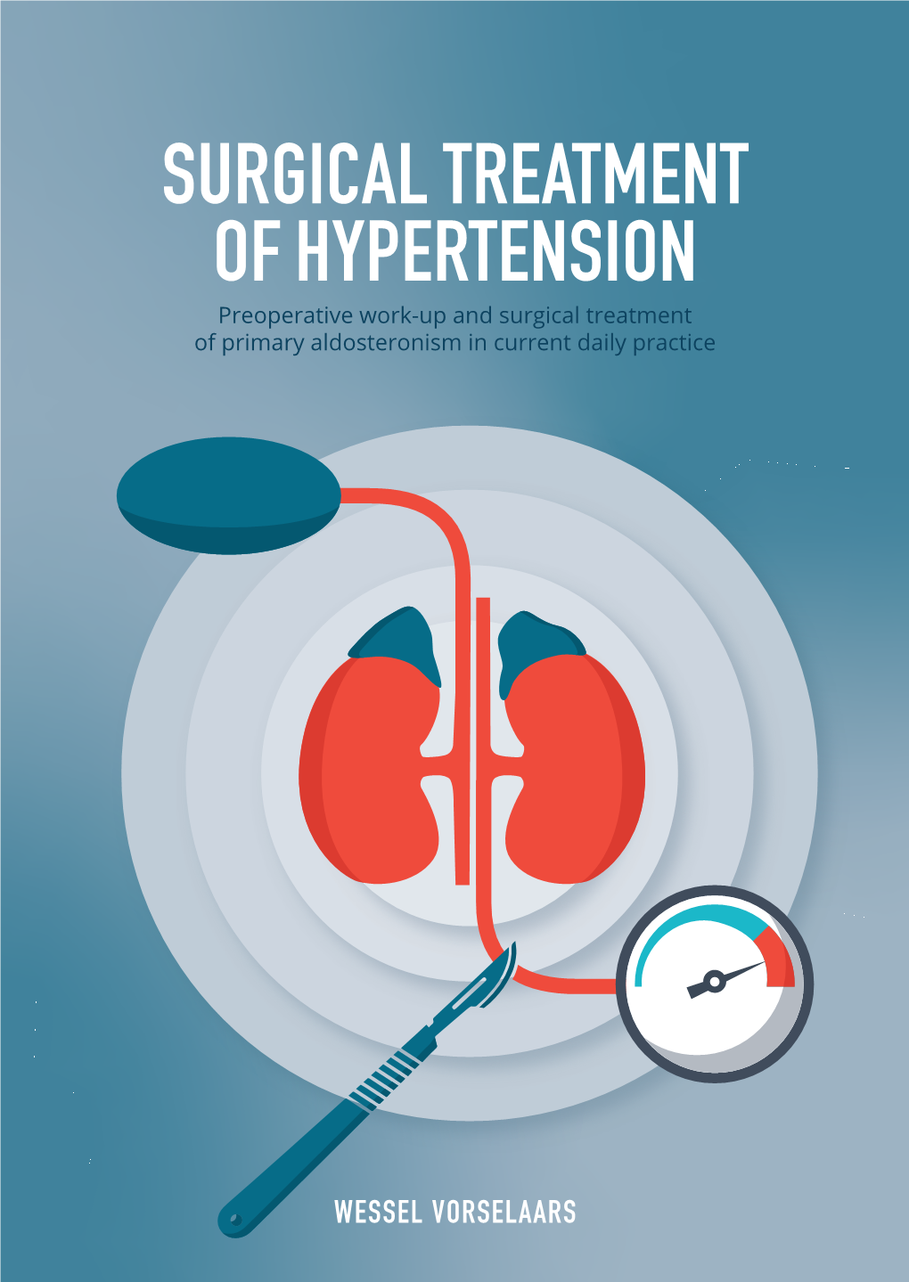 Surgical Treatment of Hypertension Wessel Vorselaars