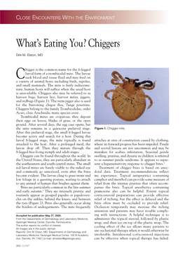 What's Eating You? Chiggers