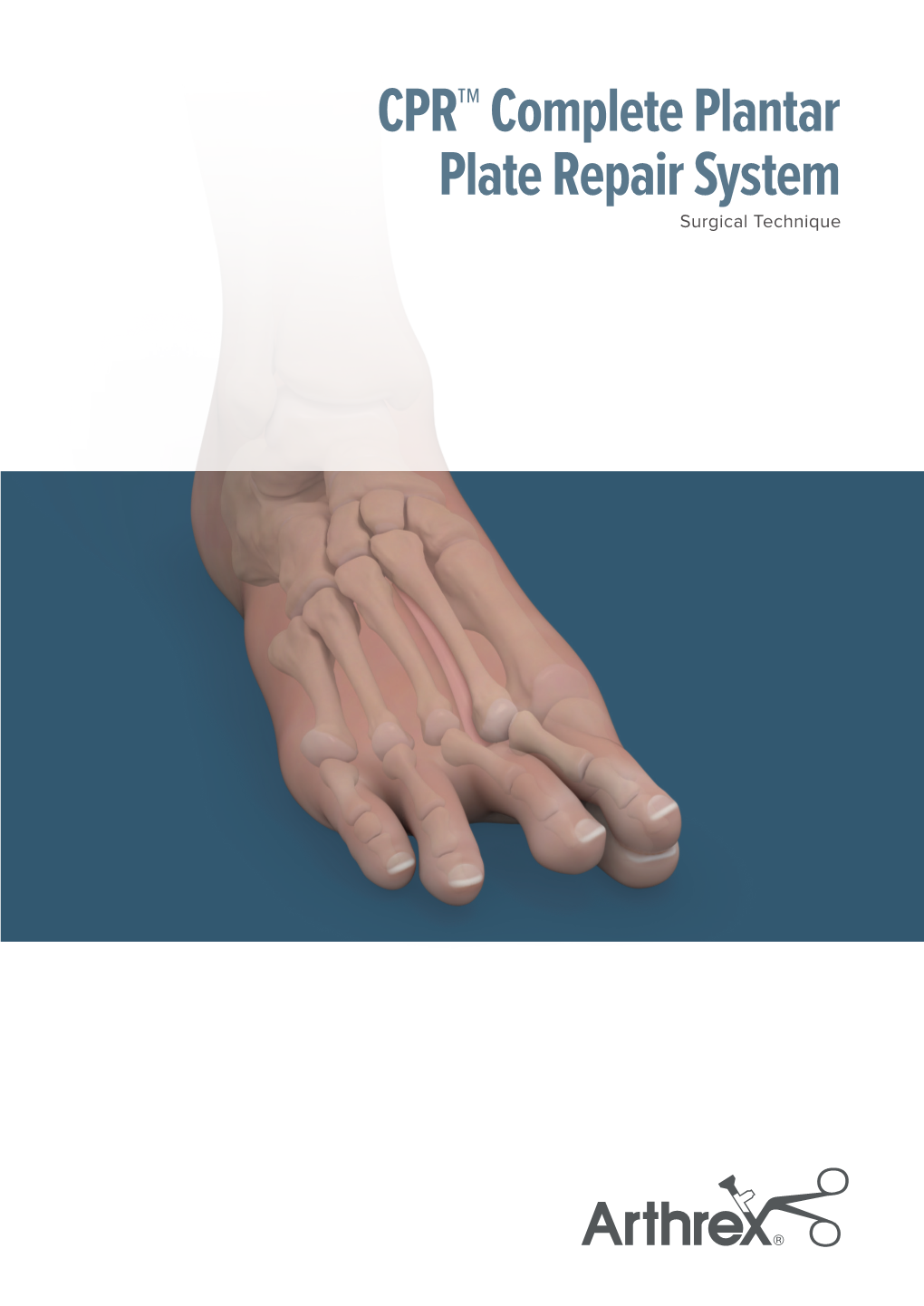 cpr-complete-plantar-plate-repair-system-surgical-technique-docslib