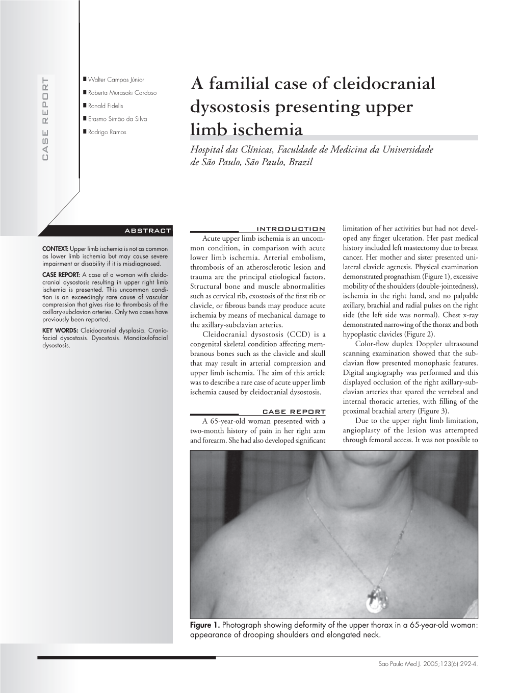 A Familial Case of Cleidocranial Dysostosis Presenting Upper Limb