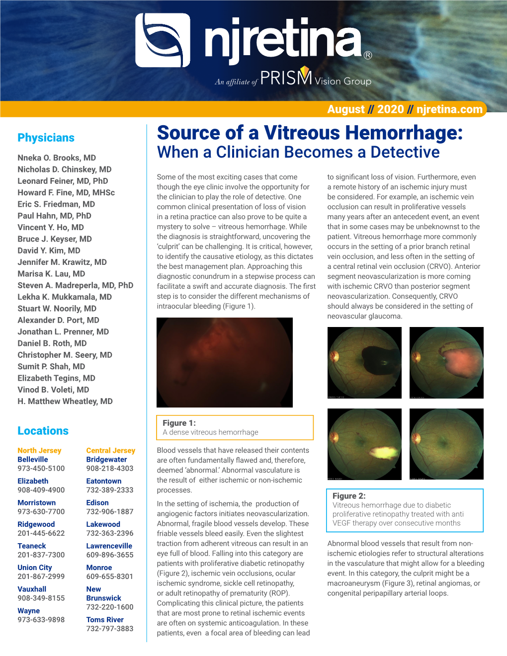 Source of a Vitreous Hemorrhage