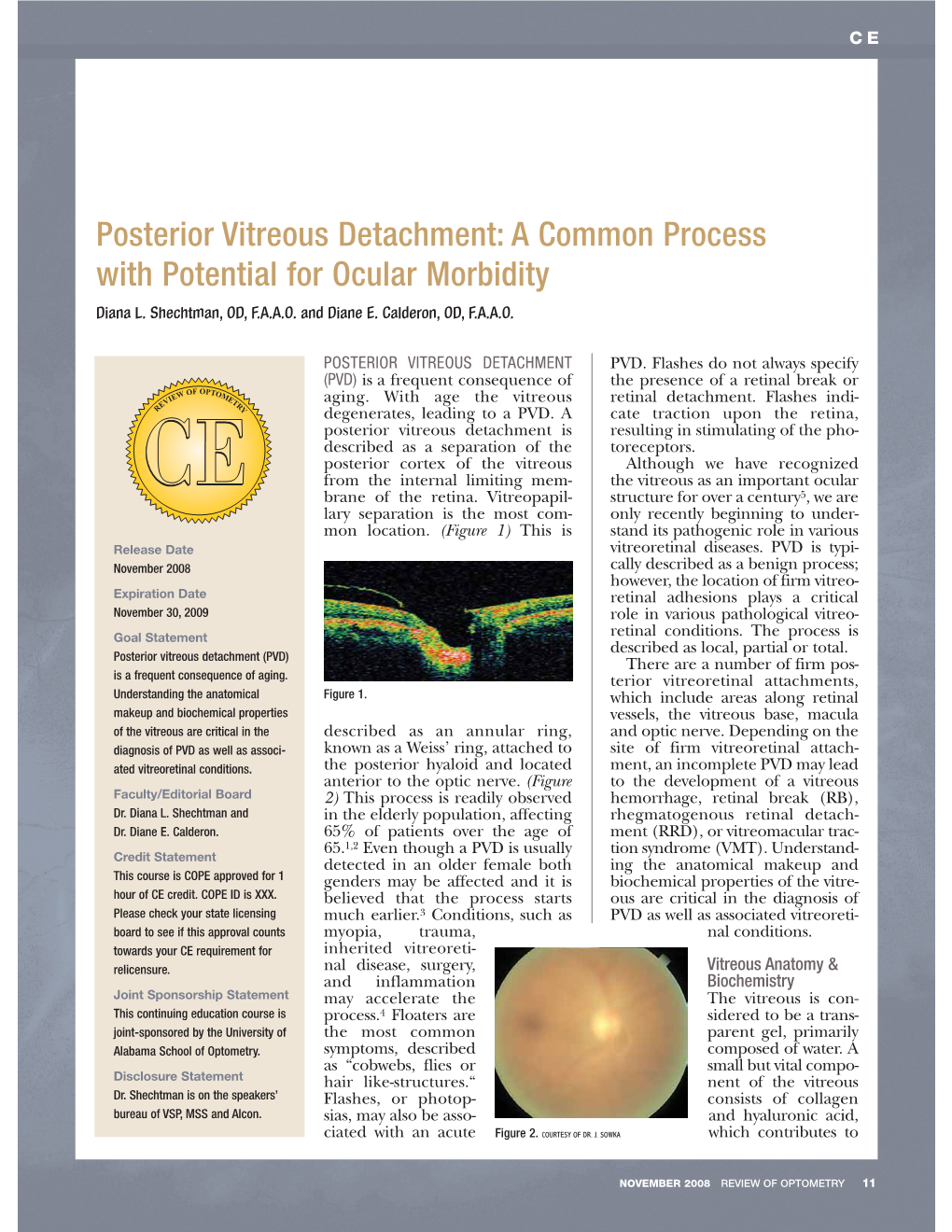 Posterior Vitreous Detachment: a Common Process with Potential for Ocular Morbidity Diana L