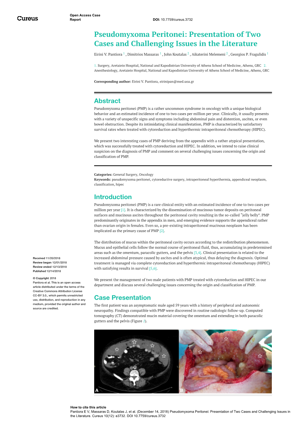 Pseudomyxoma Peritonei: Presentation of Two Cases and Challenging Issues in the Literature