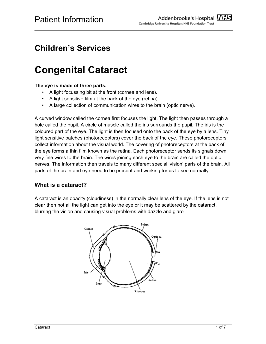 Congenital Cataract