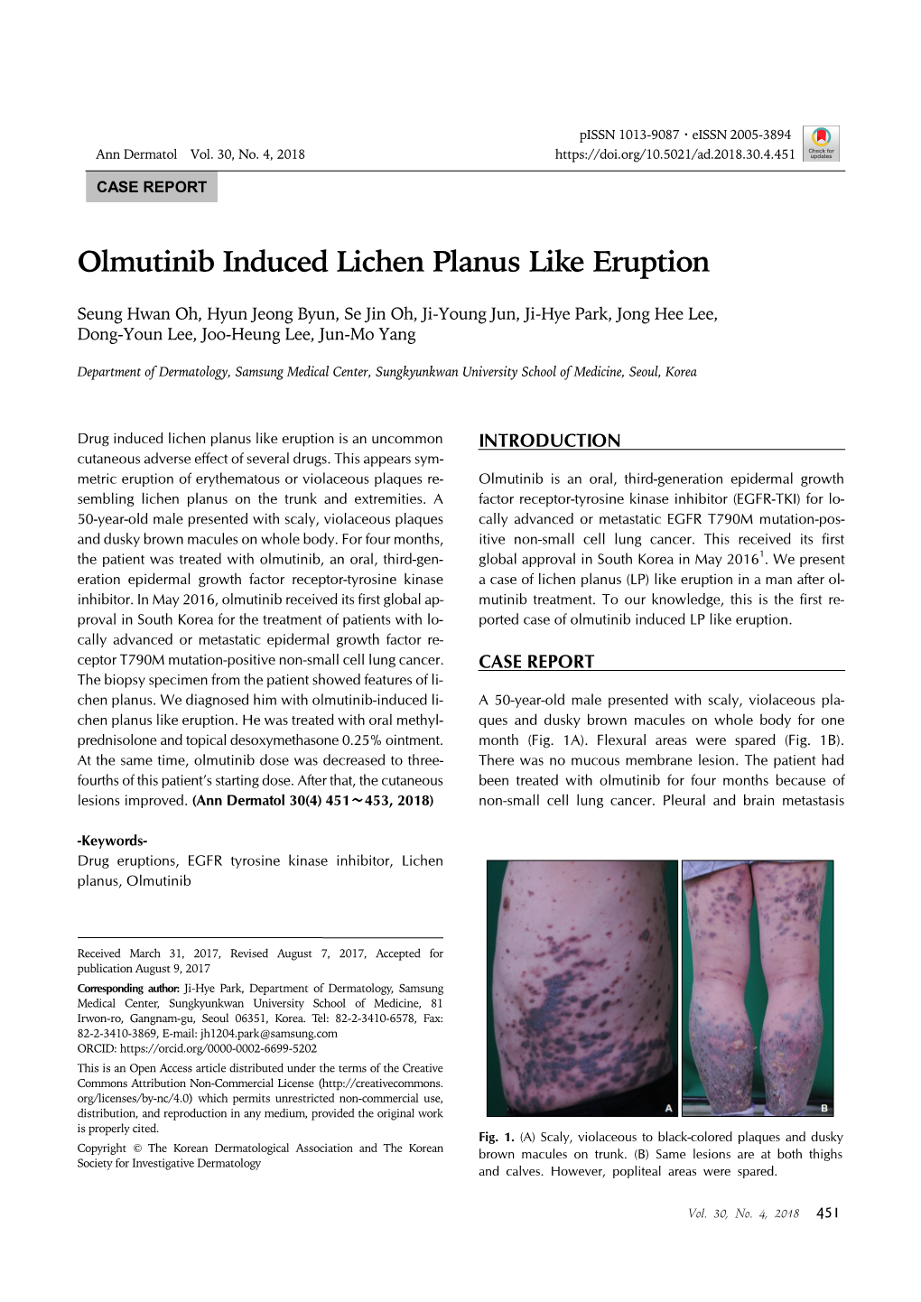 Olmutinib Induced Lichen Planus Like Eruption Pissn 1013-9087ㆍeissn 2005-3894 Ann Dermatol Vol