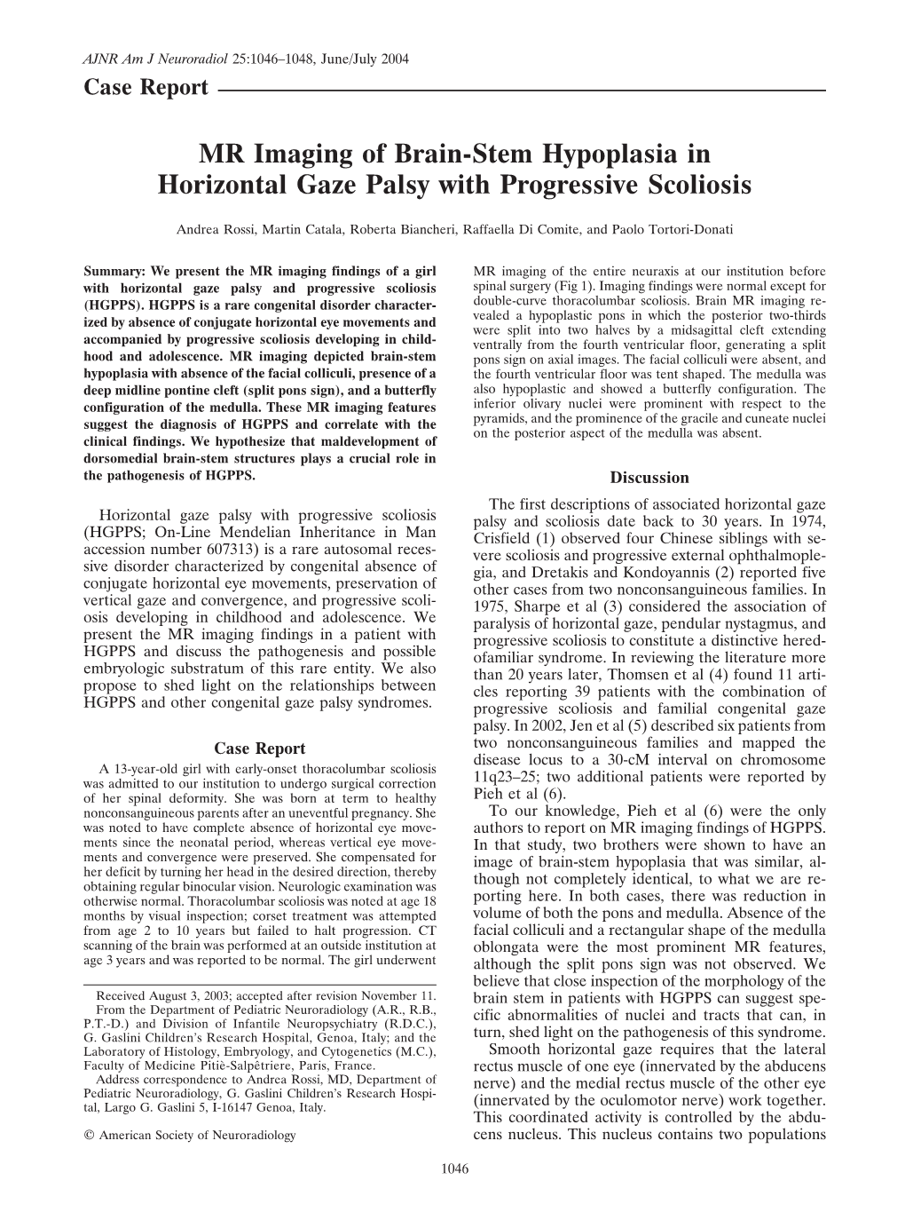 MR Imaging of Brain-Stem Hypoplasia in Horizontal Gaze Palsy with Progressive Scoliosis