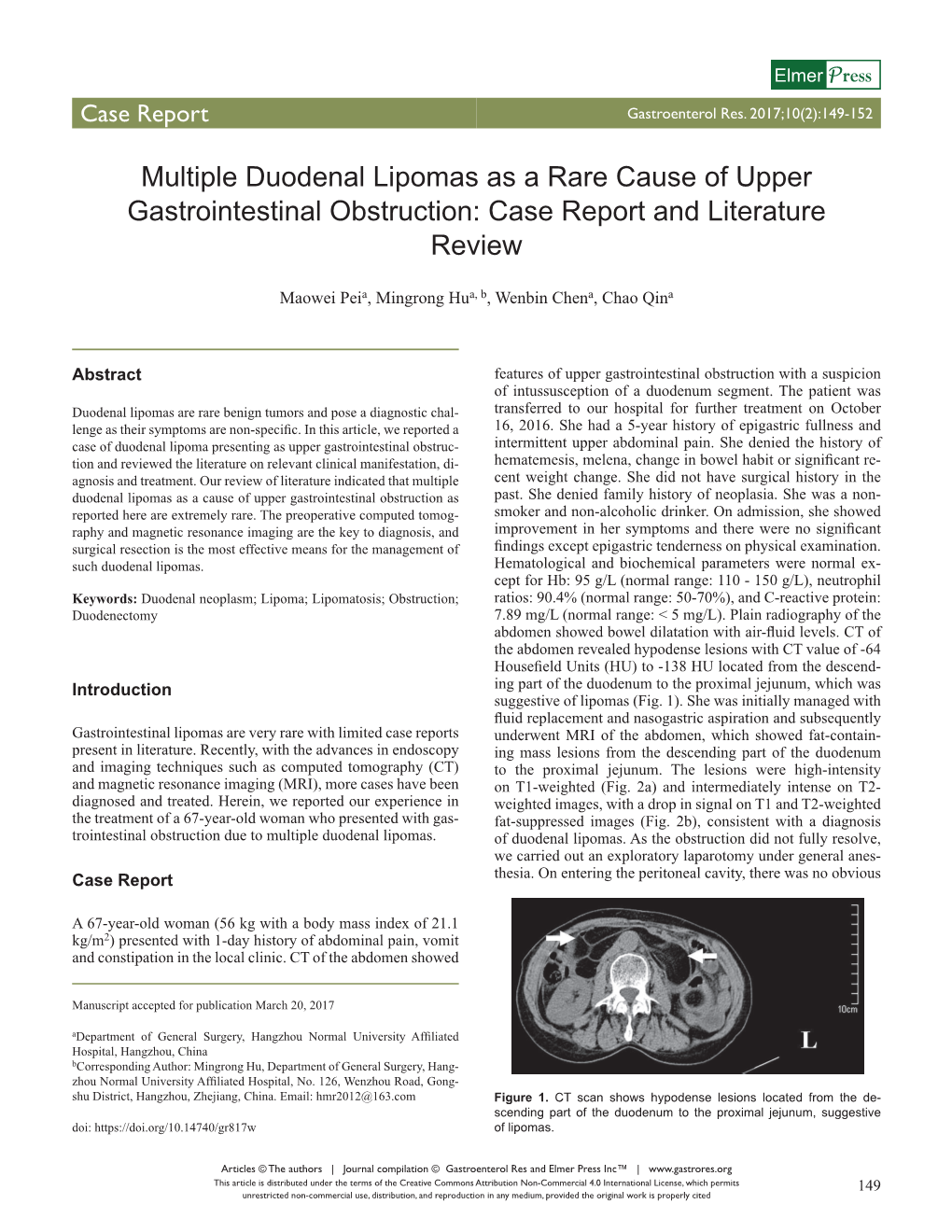 Multiple Duodenal Lipomas As a Rare Cause of Upper Gastrointestinal Obstruction: Case Report and Literature Review