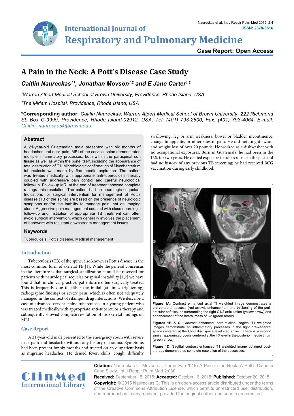 A Pain in the Neck: a Pott's Disease Case Study