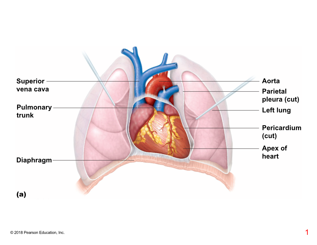 Superior Vena Cava Pulmonary Trunk Aorta Parietal Pleura (Cut) Left Lung