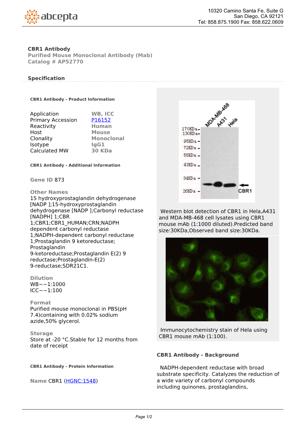 CBR1 Antibody Purified Mouse Monoclonal Antibody (Mab) Catalog # AP52770