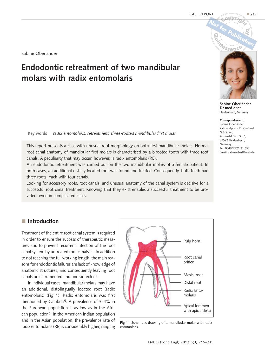 Endodontic Retreatment of Two Mandibular Molars with Radix Entomolaris