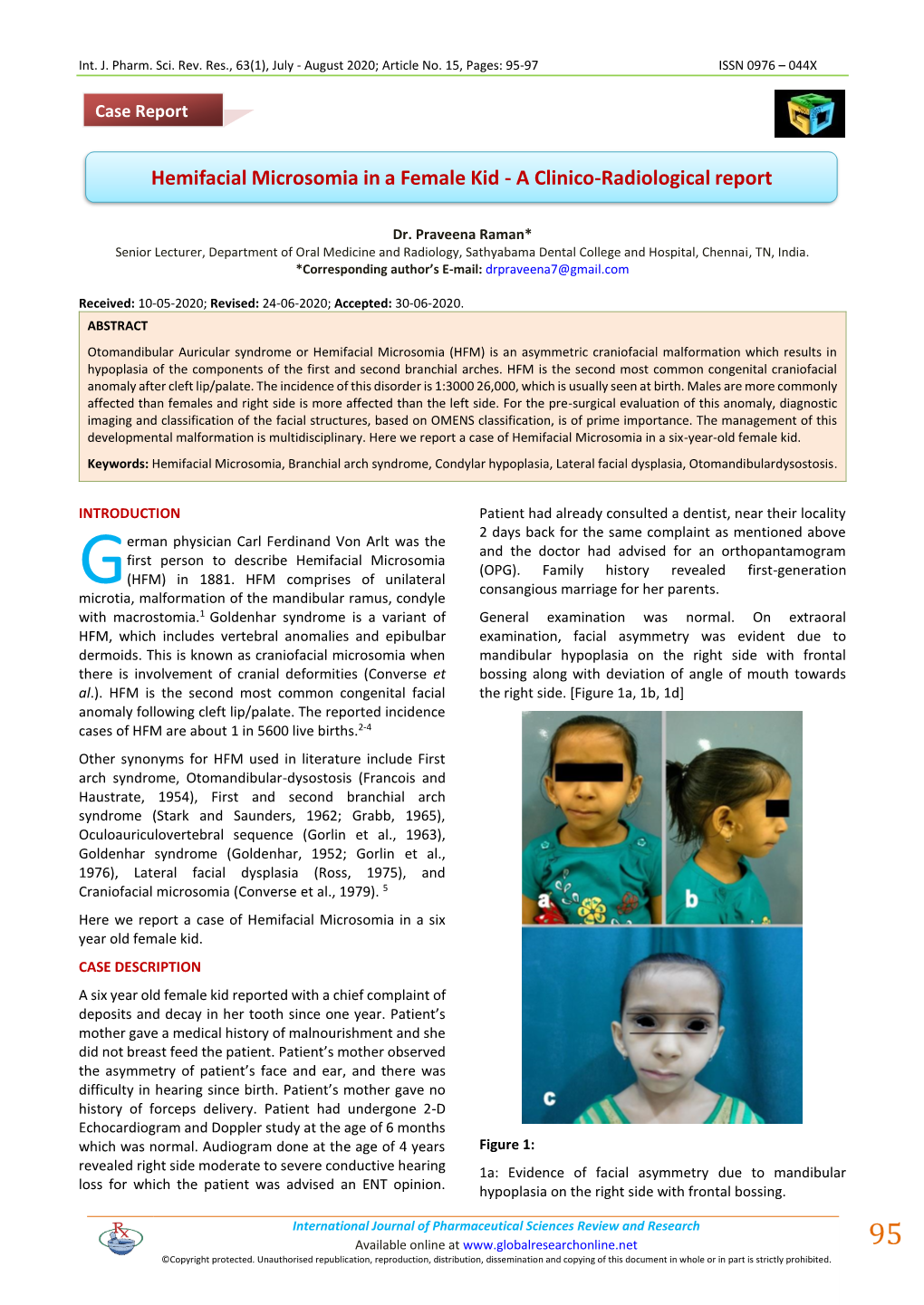 Hemifacial Microsomia in a Female Kid - a Clinico-Radiological Report