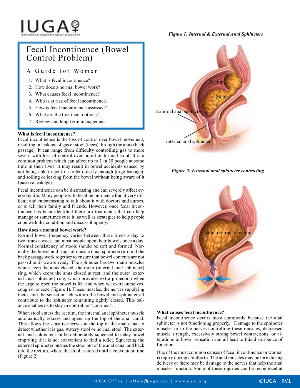 Fecal Incontinence (Bowel Control Problem) a Guide for Women