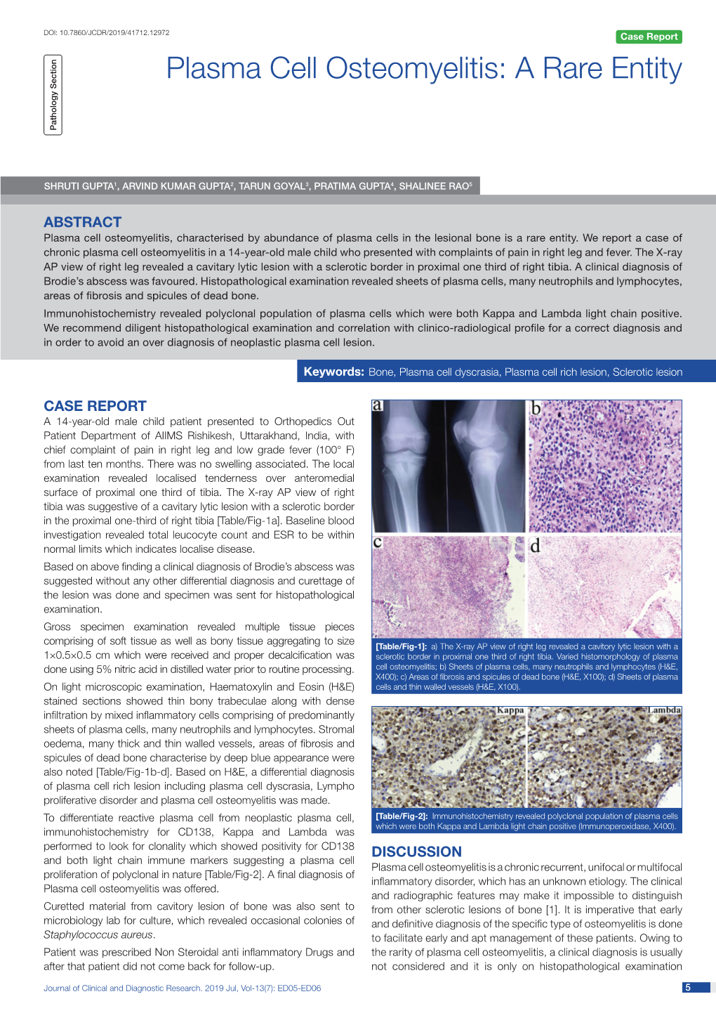 Plasma Cell Osteomyelitis: a Rare Entity Case Series Pathology Section