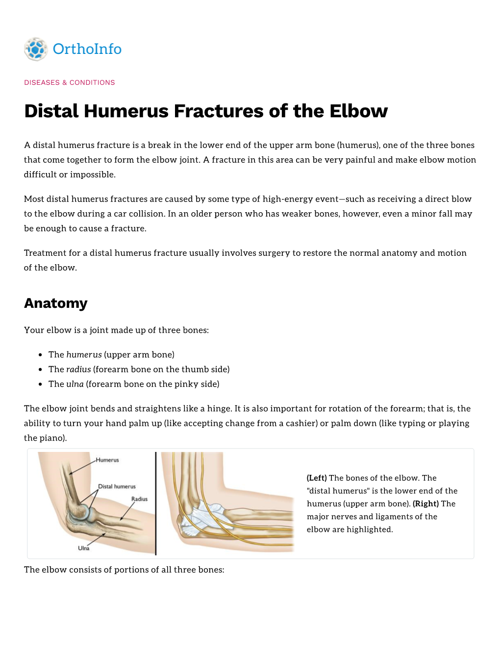 Distal Humerus Fractures of the Elbow