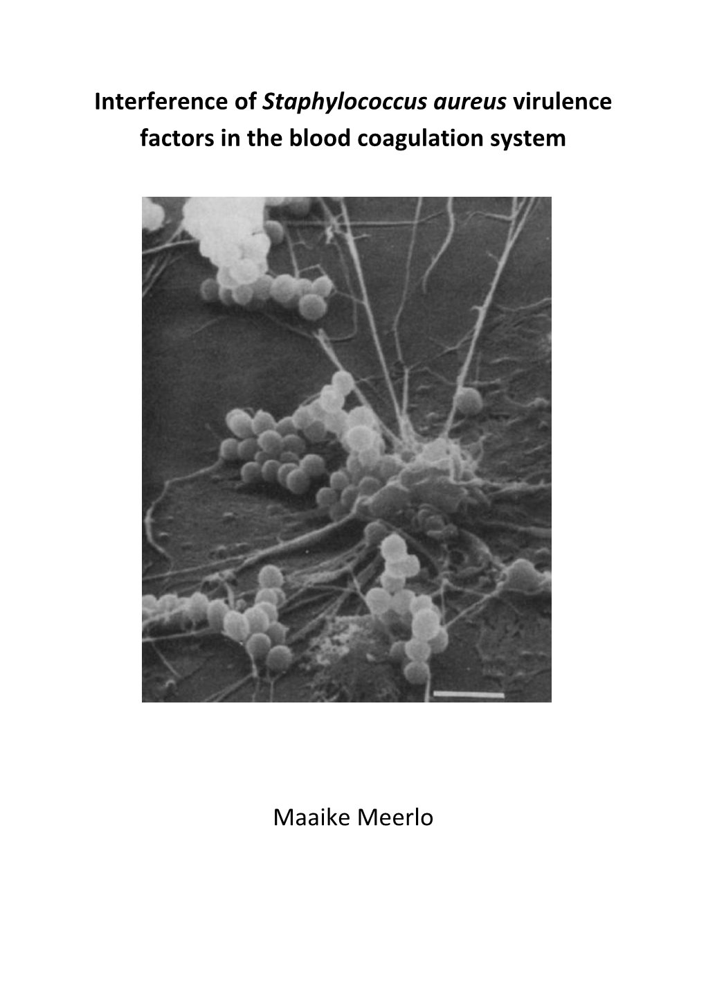 Interference of Staphylococcus Aureus Virulence Factors in the Blood Coagulation System